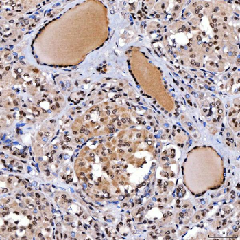 SMARCA2/BRM Antibody