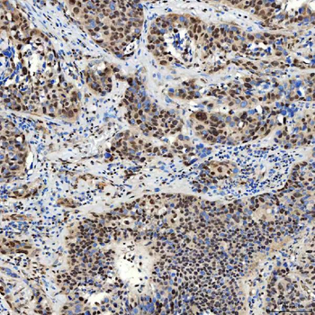 SMARCA2/BRM Antibody