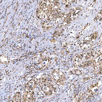 SMARCA2/BRM Antibody