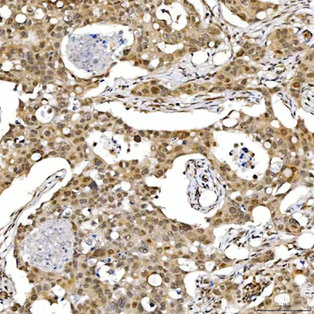 SMARCA2/BRM Antibody