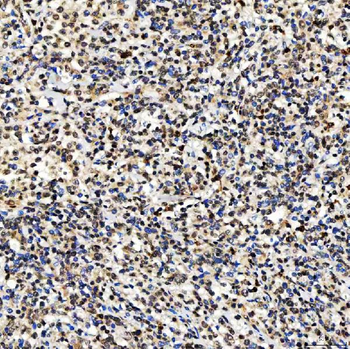 SMARCA2/BRM Antibody