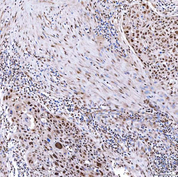 SMARCA2/BRM Antibody