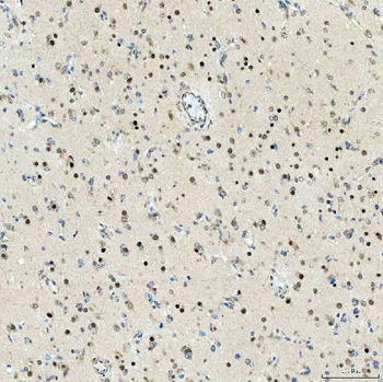 SMARCA2/BRM Antibody