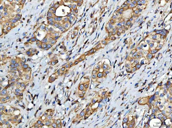 FATP4/SLC27A4 Rabbit Polyclonal Antibody