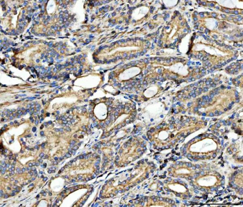 FATP4/SLC27A4 Rabbit Polyclonal Antibody