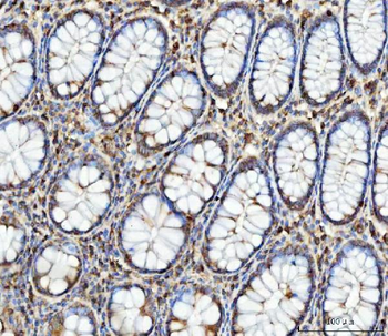 FATP4/SLC27A4 Rabbit Polyclonal Antibody