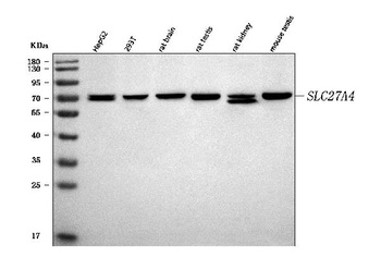 FATP4/SLC27A4 Rabbit Polyclonal Antibody