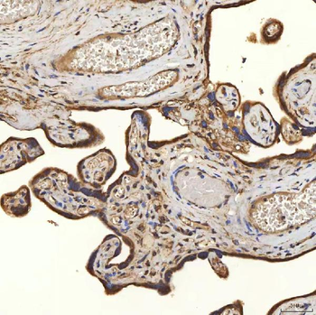 SLC25A24 Antibody