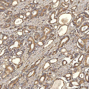 SLC25A24 Antibody