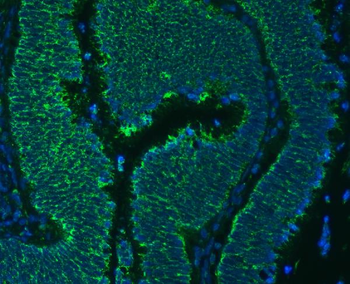 SLC25A24 Antibody