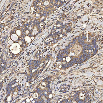SLC25A24 Antibody