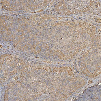 SLC25A24 Antibody