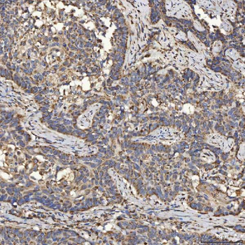 SLC25A24 Antibody