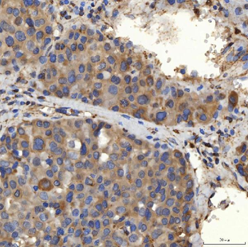 SLC25A24 Antibody