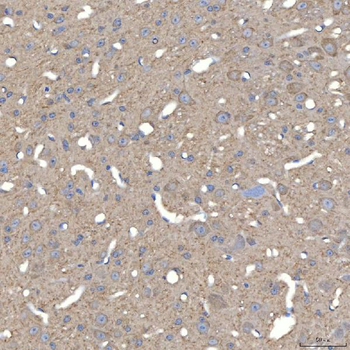SLC25A23 Rabbit Polyclonal Antibody