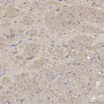 SLC25A23 Rabbit Polyclonal Antibody