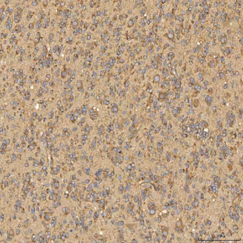 Citrin/SLC25A13 Antibody