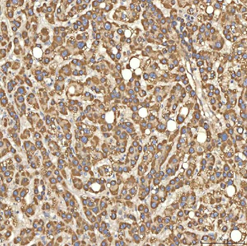 Citrin/SLC25A13 Antibody