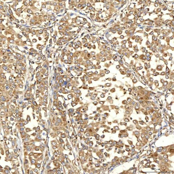Citrin/SLC25A13 Antibody