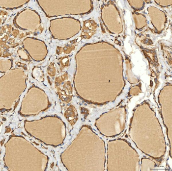 Citrin/SLC25A13 Antibody