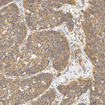 Citrin/SLC25A13 Antibody