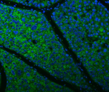Citrin/SLC25A13 Antibody