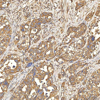 Citrin/SLC25A13 Antibody