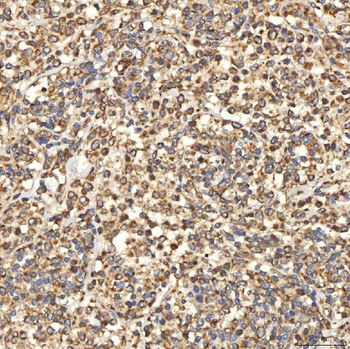 Citrin/SLC25A13 Antibody