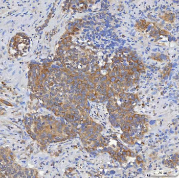 Mitochondrial dicarboxylate carrier/SLC25A10 Antibody