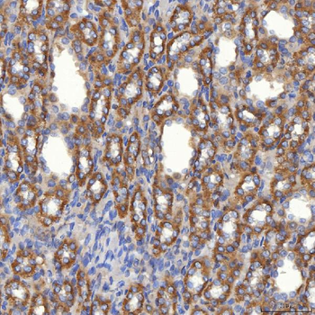 Mitochondrial dicarboxylate carrier/SLC25A10 Antibody