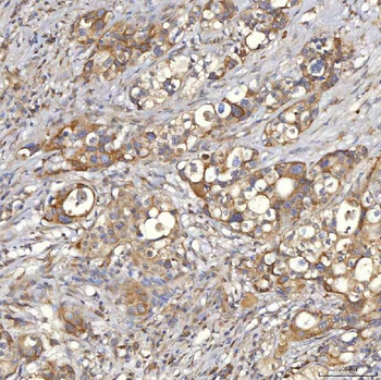 Mitochondrial dicarboxylate carrier/SLC25A10 Antibody