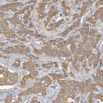 Mitochondrial dicarboxylate carrier/SLC25A10 Antibody