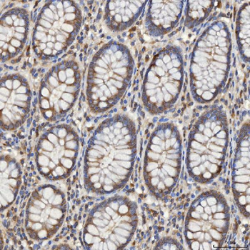 Mitochondrial dicarboxylate carrier/SLC25A10 Antibody