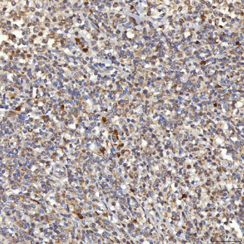 Mitochondrial dicarboxylate carrier/SLC25A10 Antibody