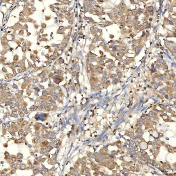 Mitochondrial dicarboxylate carrier/SLC25A10 Antibody