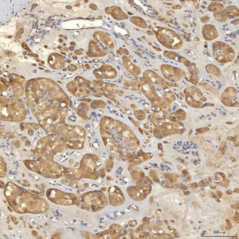 Mitochondrial dicarboxylate carrier/SLC25A10 Antibody