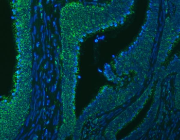 SLC20A1 Antibody