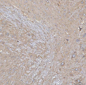 SLC20A1 Antibody