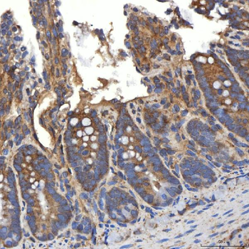 SLC20A1 Antibody