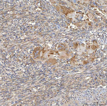 SLC20A1 Antibody