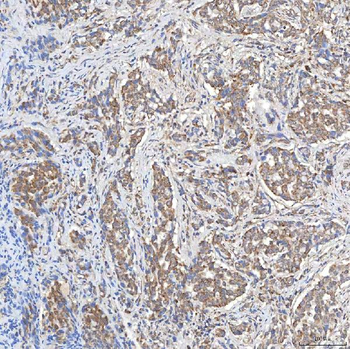 SLC20A1 Antibody