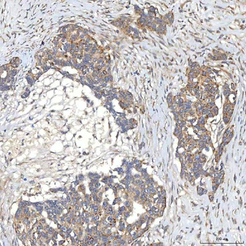 SLC20A1 Antibody