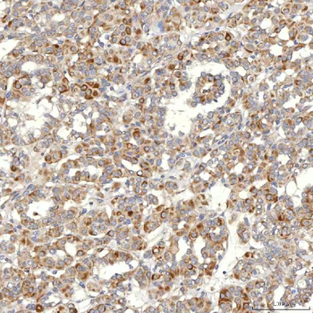 SLC20A1 Antibody