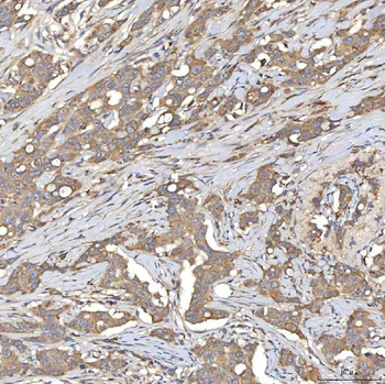 SIAE Antibody