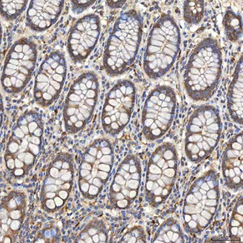 SIAE Antibody