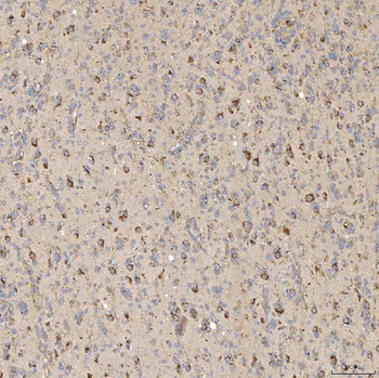 SIAE Antibody
