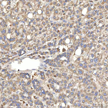 SIAE Antibody