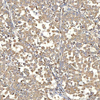SIAE Antibody