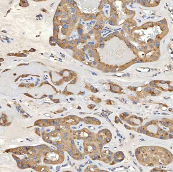 SIAE Antibody