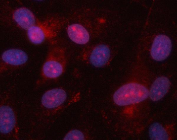 EIF2AK1 Rabbit Polyclonal Antibody